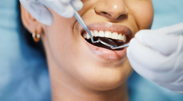 Best Knocked-Out Tooth (Avulsed Tooth) Treatment in Heber Overgaard, AZ